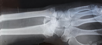 Technology is helping take the strain out of treating musculoskeletal injuries in construction